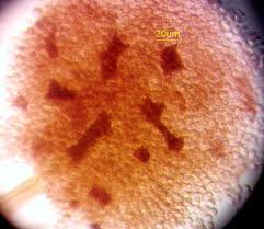 Attēlu rezultāti vaicājumam “Lycogala ustulatum macro”