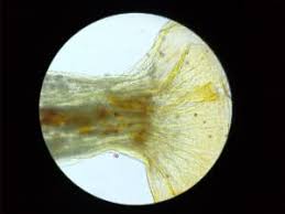 Attēlu rezultāti vaicājumam “Craterium aureum spores”