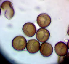 Attēlu rezultāti vaicājumam “Lycogala ustulatum macro”
