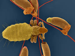 Attēlu rezultāti vaicājumam “Licea pygmaea macro”