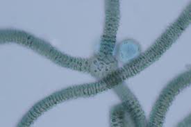 Attēlu rezultāti vaicājumam “Arcyria stipata spores”