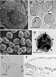 Attēlu rezultāti vaicājumam “Melampsora epitea”