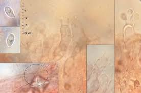 Attēlu rezultāti vaicājumam “Rimbachia neckerae”