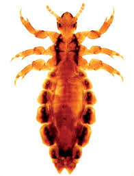 Attēlu rezultāti vaicājumam “Pediculus humanus capitis”