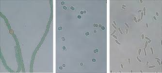 Attēlu rezultāti vaicājumam “Cyanophyta”