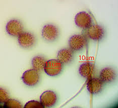 Attēlu rezultāti vaicājumam “Oligonema persimile sessile”