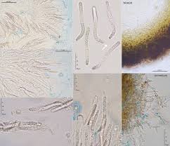 Attēlu rezultāti vaicājumam “Lasiosphaeria ovina”