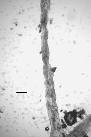 Attēlu rezultāti vaicājumam “Stemonaria irregularis stalked”