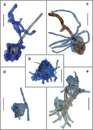 Attēlu rezultāti vaicājumam “Octosporella jungermanniarum”