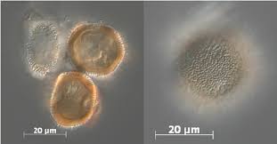 Attēlu rezultāti vaicājumam “Gymnosporangium sp.”