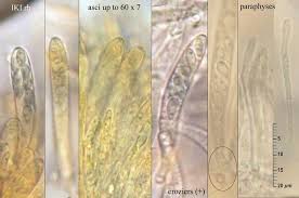 Attēlu rezultāti vaicājumam “Hyphodiscus hymeniophilus”