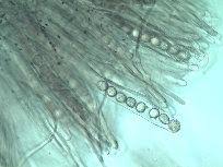 Attēlu rezultāti vaicājumam “Octospora splachnophila spores”