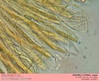 Attēlu rezultāti vaicājumam “Bisporella citrina”