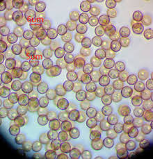 Attēlu rezultāti vaicājumam “Stemonitopsis hyperopta var. landewaldii”
