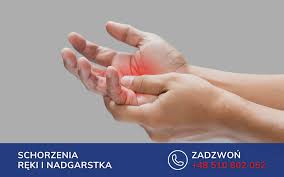 Znalezione obrazy dla zapytania palec