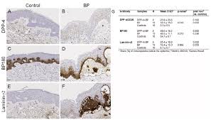Attēlu rezultāti vaicājumam “Pemphigus borealis”