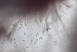 Attēlu rezultāti vaicājumam “Chlorencoelia versiformis”