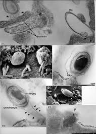 Attēlu rezultāti vaicājumam “Enteridium variabile spores”
