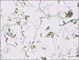Attēlu rezultāti vaicājumam “Diderma subviridifuscum var. macrospora* spores”