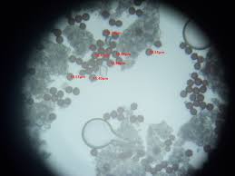 Attēlu rezultāti vaicājumam “Didymium annulisporum”