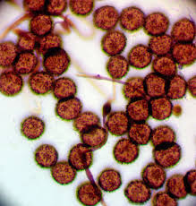 Attēlu rezultāti vaicājumam “Didymium annulisporum sessile”