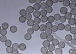 Attēlu rezultāti vaicājumam “Didymium annulisporum spores”