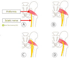 Attēlu rezultāti vaicājumam “Cribraria piriformis”