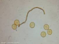 Attēlu rezultāti vaicājumam “Perichaena corticalis”