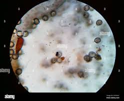 Attēlu rezultāti vaicājumam “Physarum psittacinum spores”