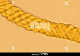 Attēlu rezultāti vaicājumam “Oligonema favogineum”