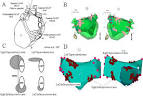 ScienceDirect.com - Heart Rhythm - Selective ganglionated plexi ...