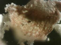 Attēlu rezultāti vaicājumam “Diderma subincarnatum sessile”