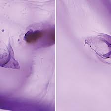 Attēlu rezultāti vaicājumam “Aleurochiton aceris nymph”