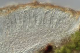 Attēlu rezultāti vaicājumam “Lecanora conizaeoides”