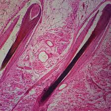 Image result for human hair microscope image