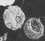 Attēlu rezultāti vaicājumam “Chaenotheca gracilenta”