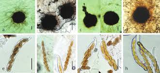 Attēlu rezultāti vaicājumam “Stemonitopsis aequalis var. microspora spores”