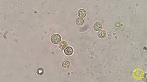 Attēlu rezultāti vaicājumam “Cribraria microcarpa spores”