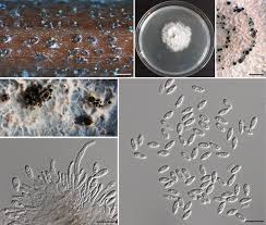 Attēlu rezultāti vaicājumam “Diachea dictyospora (syn. Craterium dictyosporum) spores”