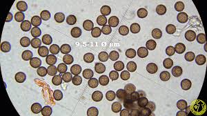 Attēlu rezultāti vaicājumam “Didymium melanospermum spores”