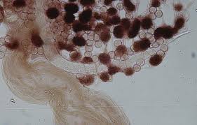 Attēlu rezultāti vaicājumam “Cribraria microcarpa spores”