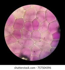 Attēlu rezultāti vaicājumam “Leiocolea rutheana cells”
