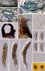 Attēlu rezultāti vaicājumam “Rosellinia desmazieri spores”