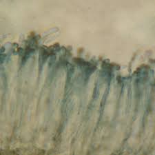 Attēlu rezultāti vaicājumam “Hertelidea botryosa”