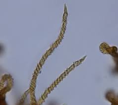 Attēlu rezultāti vaicājumam “Trichia contorta”