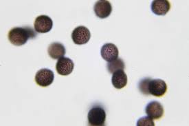 Attēlu rezultāti vaicājumam “Diderma chondrioderma spores”