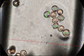 Attēlu rezultāti vaicājumam “Stemonitis fusca spores”