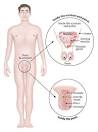 Treatment options for Andropause « United Medical Network