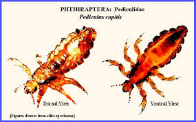Attēlu rezultāti vaicājumam “Licea pygmaea sessile”