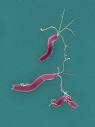 Helicobacter: The Bacteria that Cause Ulcers | General center ...